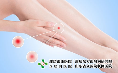 攝圖網_500774826_皮膚發炎(企業商用) 攝圖網_500774826_皮膚發炎(企業商用)