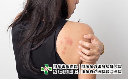 肩膀 癥狀 肩膀 癥狀