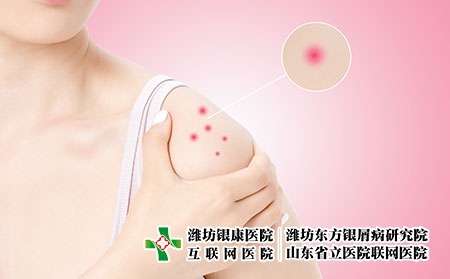 攝圖網_500983105_肩部過敏紅腫（企業商用）