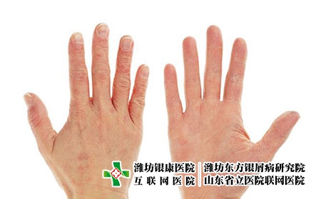 2 (281)手 2 (281)手