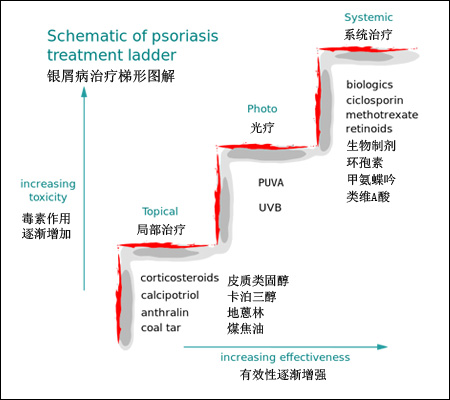 濰坊東方銀屑病研究院提示銀屑病不同療法的不同反應(yīng)