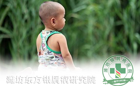 牛皮癬的輔助治療方法你了解多少