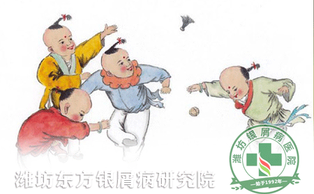 牛皮癬患者多踢毽子可緩解慢性骨關(guān)節(jié)疾病