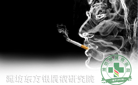 吸煙會(huì)加重牛皮癬嗎