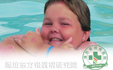 兒童銀屑病患者冬季需要知道的護理常識