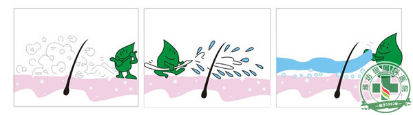 銀屑病患者的皮膚護理寶典