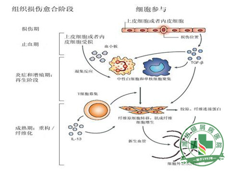 銀屑病可不藥而愈