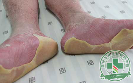 濰坊銀屑病醫院地理位置