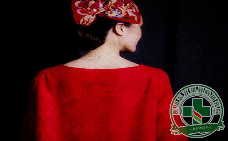 排毒養顏飲食機制，讓女性銀屑病患者光彩照人