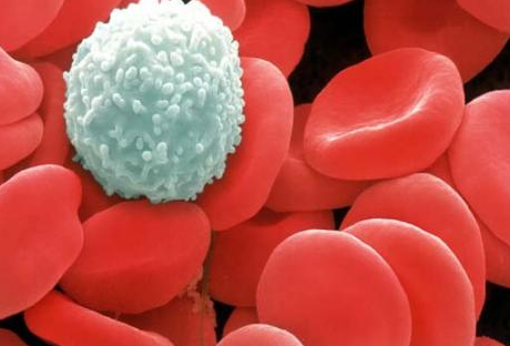 春季邪氣生發(fā)，銀屑病患者該如何提高抵抗力對(duì)抗病魔？