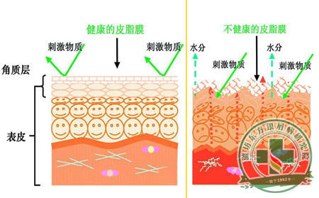調(diào)整:銀屑病患者夏季如何促使面部肌膚水潤光澤