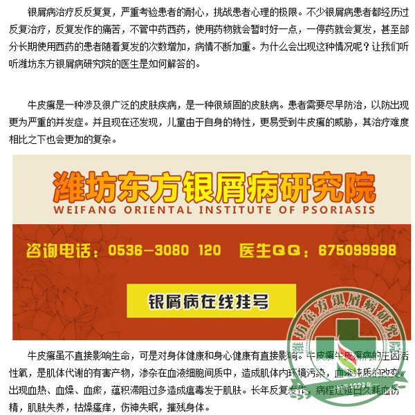 透析銀屑病病因 針對病因找出合理銀屑病治療出路