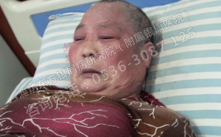 入院時局部皮膚情況