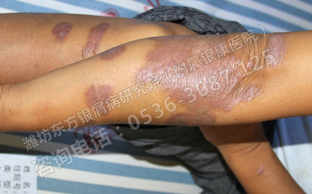 濰坊銀霄病醫院