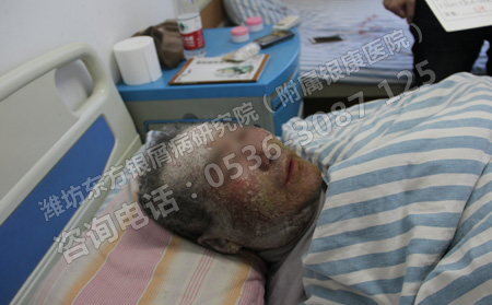 濰坊牛皮癬醫(yī)院哪位醫(yī)生可以?要怎么聯(lián)系