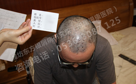 濰坊中醫治療牛皮癬醫院遠期治療效果穩定