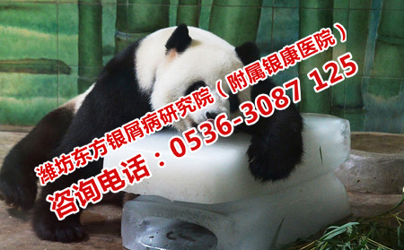 高溫天氣牛皮癬護(hù)理的著重點(diǎn)