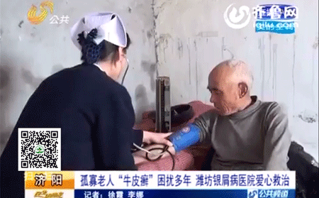 治療老人銀屑病