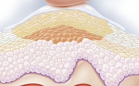 濰坊東方銀屑病研究院預約方式