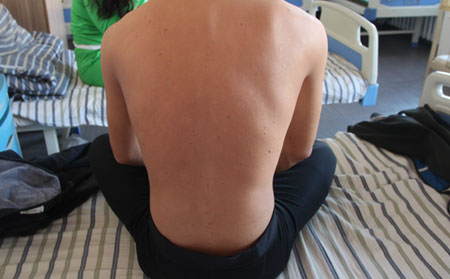 沒有好的牛皮癬的原因