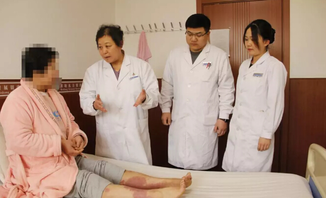 "五重標準"教您辨清真正的銀屑病可以醫院