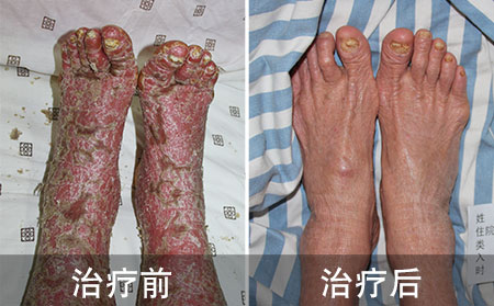 濰坊東方分享適度用藥的重要性