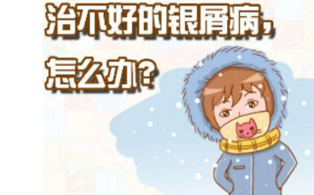 銀屑病應該怎么進行預防
