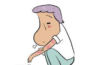 兒童銀屑病應該怎么進行護理