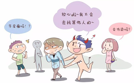 銀屑病會不會傳染