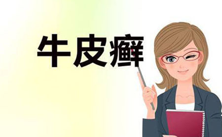 銀屑病患者應該怎么注意預防