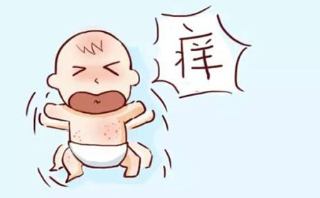 銀屑病的癥狀有什么