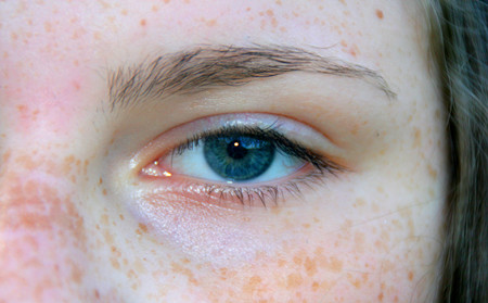 濰坊銀屑病醫生