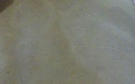 銀屑病的護(hù)理方法有什么