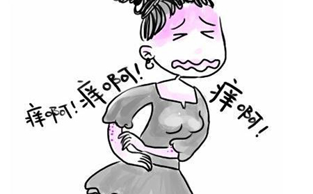 濰坊銀屑病應該怎么進行預防