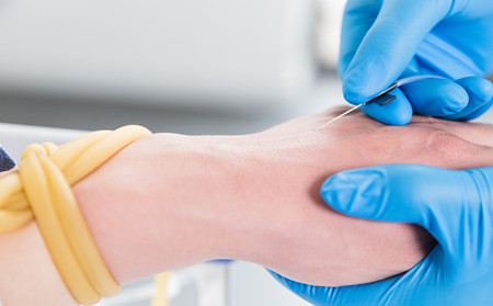 濰坊東方銀屑病醫生