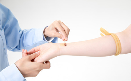 濰坊平度牛皮癬治療醫院