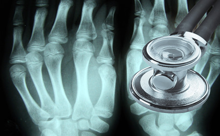 濰坊治療關節型牛皮癬