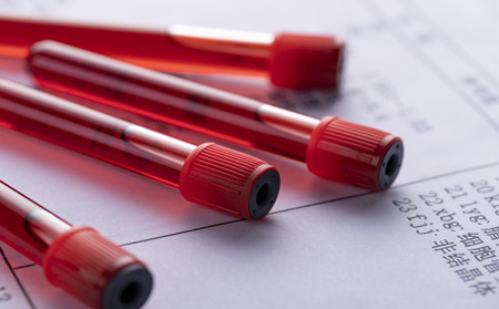 濰坊比較好的銀屑病醫院