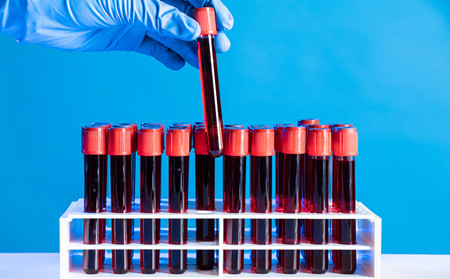 看銀屑病濰坊哪個醫院專業