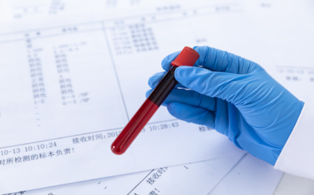 濰坊銀屑病醫院收費,濰坊銀屑病醫院治療費用