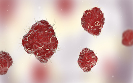 兒童銀屑病護(hù)理,怎樣護(hù)理兒童銀屑病