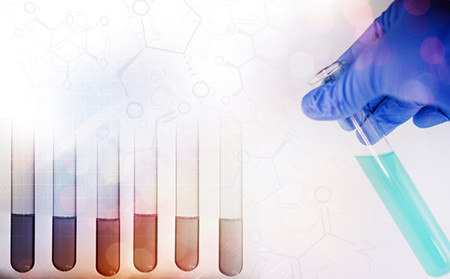 誘發(fā)銀屑病因素,銀屑病發(fā)病原因