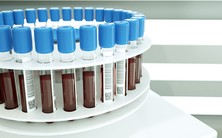 牛皮癬病因,什么因素引發(fā)牛皮癬