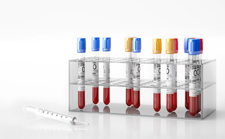 銀屑病治療,銀屑病治療如何進行
