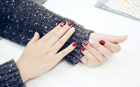 銀屑病病因,銀屑病指甲變形