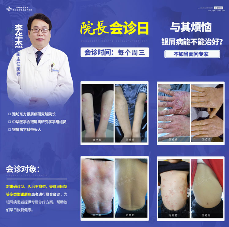 李華杰會(huì)診日,周三院長(zhǎng)會(huì)診日