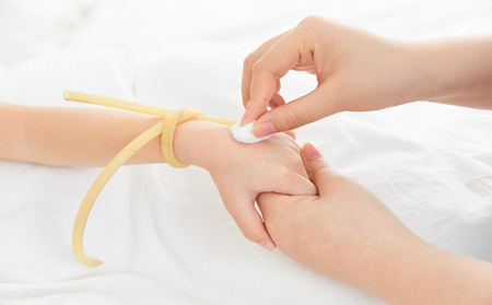 銀屑病治療新方法,什么新方法治銀屑病