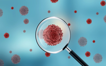 手部牛皮癬護理,手上有牛皮癬怎樣護理