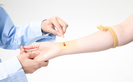 濰坊牛皮癬治療,牛皮癬治療