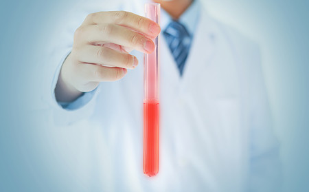 膿皰型銀屑病治療,膿皰型銀屑病多久能好